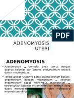 Adenomiosis - Mida