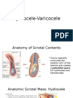 Hydrocele Varicocele