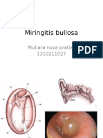 Miringitis Bullosa