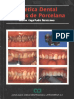 Estética Dental - Carillas de Porcelana (Copia de NXPowerLite)