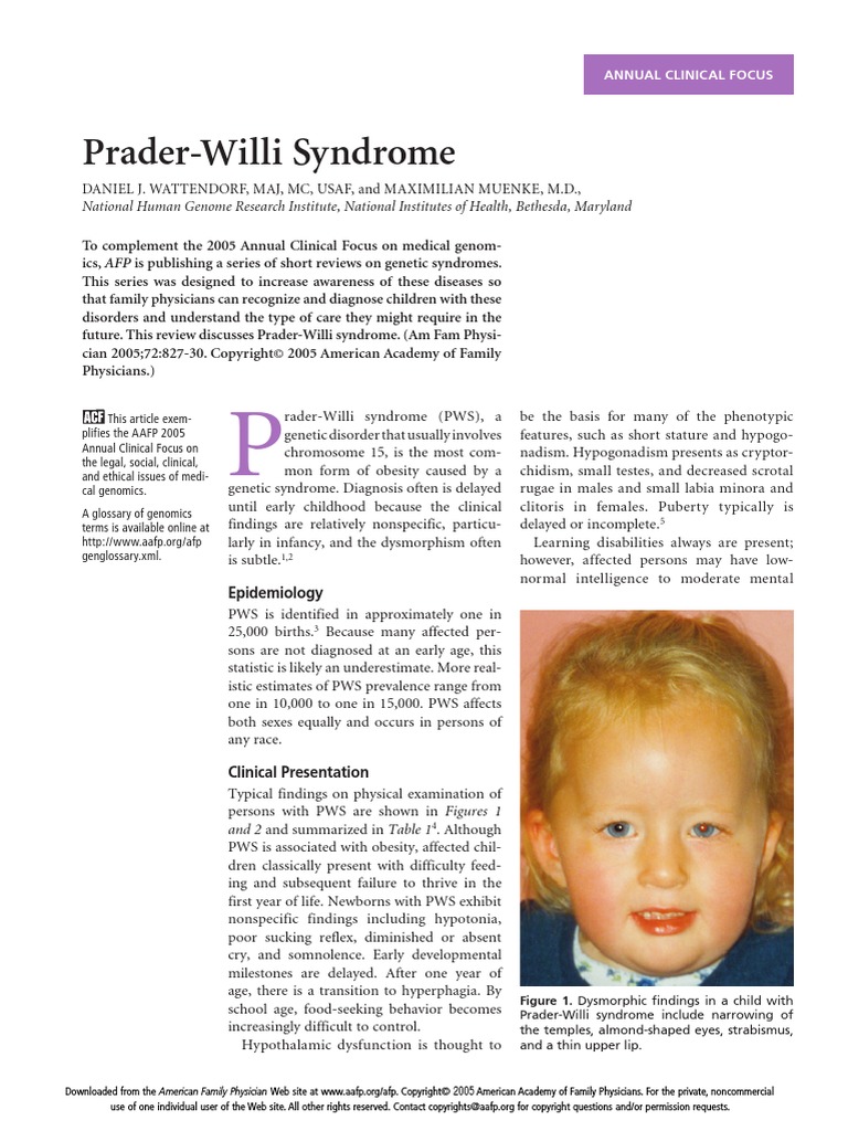 Exclusive Access: Discover The Secrets Of **Prader Willi Syndrome Pictures**. - 4k2oygx