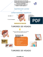 Tumor de Hígado