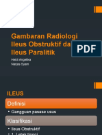 Gambaran Radiologi Ileus Obstruktif Dan Ileus Paralitik