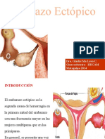 Embarazo Ectopico