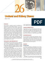 Ureteral and Kidney Stones: Jorge A. Soto