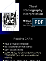 Chest X Ray Made Simple