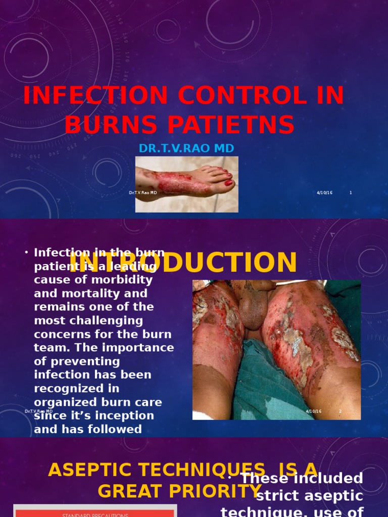 Infection Control in Burn Patients | PDF | Infection | Infection Control