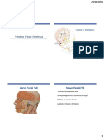 Paralisia Facial Periférica