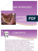 Carcinoma Intraoseo Primario-mayree Ramos Valdez