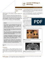 Malignant Transformation of Nasal Polyposis Case Report and Review of the Literature WeCR