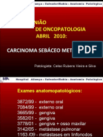 Carcinoma sebáceo // Patologia
