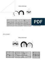 EKG Hipertrofie Si Ischemie