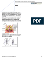 Bartholin Gland Marsupialization - Overview, Periprocedural Care, Overview of Technique