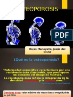 Osteoporosis Primaria