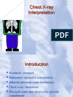 Chest X-Ray Simulasi