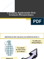 Gradação Histopatologica Do Carcinoma Epidermoide Oral