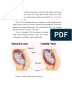LP Plasenta Previa