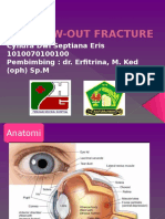 Blow Out Fracture