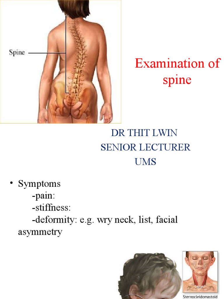 Examination of Spine: DR Thit Lwin Senior Lecturer UMS | PDF ...