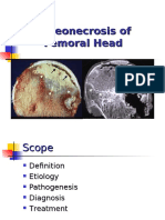 Osteonecrosis of Femoral Head