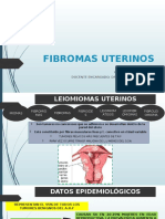 Fibromas Uterinos