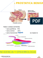 Hiperplasia Prostatica Benigna