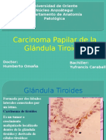 Carcinoma Papilar de la Glándula Tiroides.pptx
