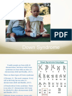 Down Syndrome Powerpoint-A Cornelius