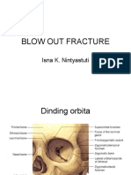BLOW OUT FRACTURE.ppt