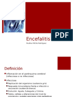 Encefalitis 