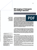 MRI Ewing Sarcoma