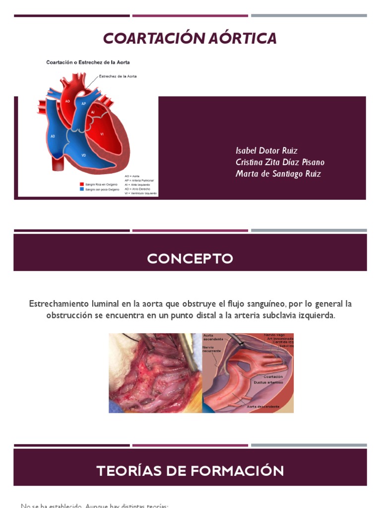 Comprensión de la coartación aórtica clasificación, síntomas y