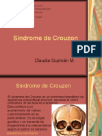Síndrome de Crouzon 
