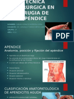 Técnica Quirúrgica en Cirugia de Apéndice