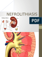 Nefrolitiasis Tutorial