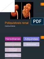 Poliquistosis Renal