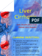 Liver Cirrhosis: Irish Nicole Dela Cruz Gessel Ann Boguen