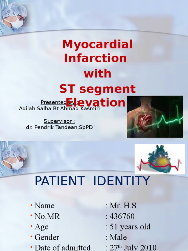 Myocardial Infarction With ST Segment Elevation | PDF | Myocardial ...