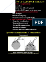 24compl's Cataract Surgery