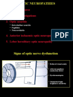 57optic Neuropathies