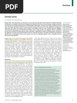 Caries dental