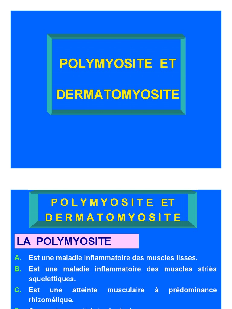 Polymyosite et dermatomyosite : Guide clinique | PDF | Muscle ...