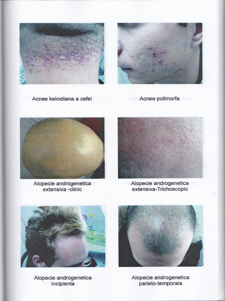 Dermatologie Atlas | PDF