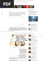 Óleo de Coco Mata 93% Das Células Cancerígenas de Cólon Em Apenas Dois Dias _ Sempre Questione - Notícias Alternativas, Ufologia, Ciência e Mais