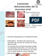 Lesiones Seudotumorales de La Mucosa Oral
