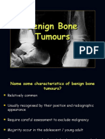 Characteristics and Types of Benign Bone Tumours