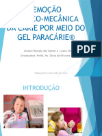 Remoção Químico e Mecânica Do Tecido Cariado