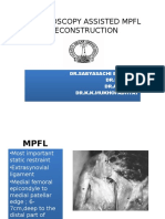 arthroscopyassistedmpflreconstruction-140216022132-phpapp01