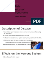 Fetal Alcohol Syndrome