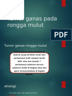 Tumor Ganas Pada Rongga Mulut (Autosaved)